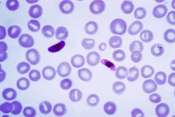 Малярийный плазмодий малярия