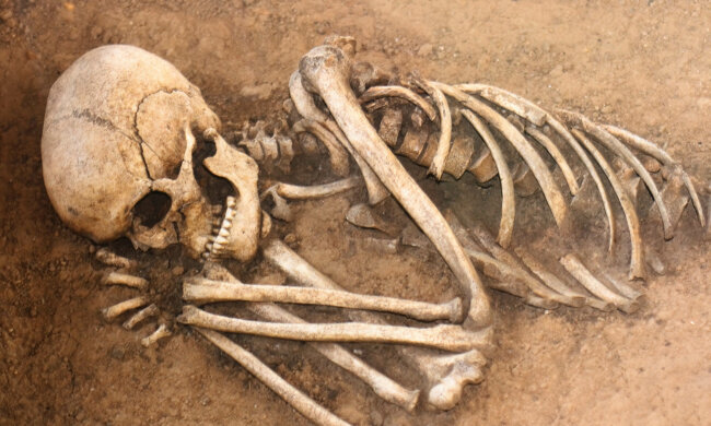 Кости-человек