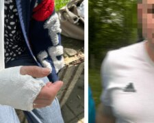 "Называл нас тряпками": житель Польши напал на украинскую семью и сломал женщине руку