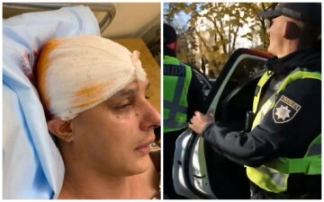Побиття продюсера KAZKA, ким виявився нападник: "З такими травмами в лікарню зазвичай приїжджають вже в комі"