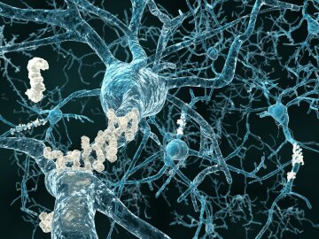 болезнь альцгеймера белки нейроны мозг