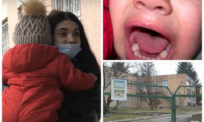 Дворічний малюк прийшов з дитсадка з розрізаним язиком, відео: вихователі звинуватили маму