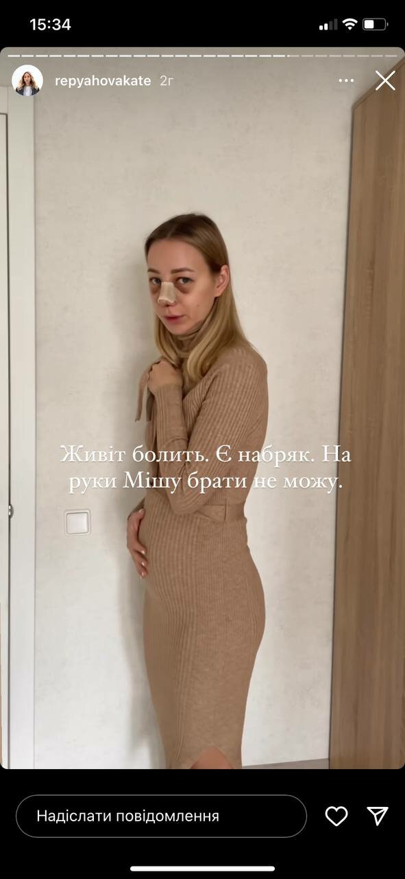 iwUaA4DJFHVnp4P2FXlL6Lh1HaMP8uH5CCvSXUCN