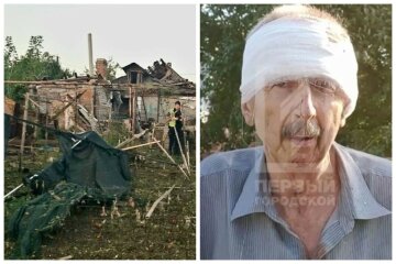 Житель Кривого Рога оказался в эпицентре ракетного удара: "Только успел закрыть глаза руками"
