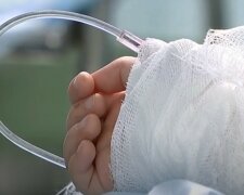 "Необходимо спасать руки": маленькая украинка прыгнула в кипяток, за жизнь малышки борются врачи