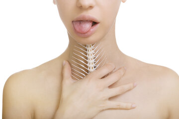 рыбная кость