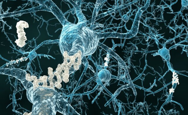болезнь альцгеймера белки нейроны мозг