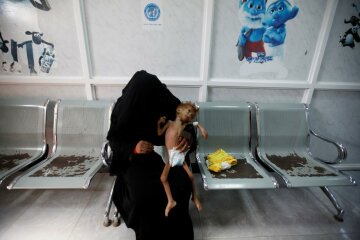 A woman holds her malnourished son at a malnutrition intensive care unit in the Red Sea port city of Houdeidah, Yemen November 17, 2016. REUTERS/Khaled Abdullah