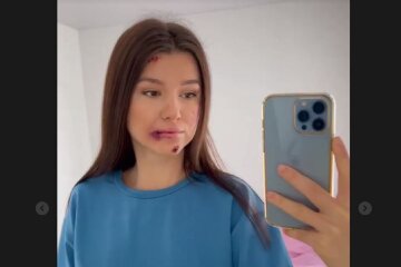 Фіналістка "Холостяка" Юлія "Зайка" здивувала виглядом, кадри: "Не лякайтеся..."