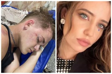 Надя Дорофєєва розповіла, що зараз з її танцюристом, якого побили до коми: "Наш Женечка..."