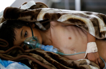 Епідемія холери в Ємені: десятки загиблих, тисячі хворих