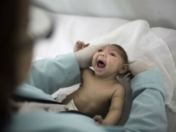 В Европе родился первый ребенок с вирусом Зика