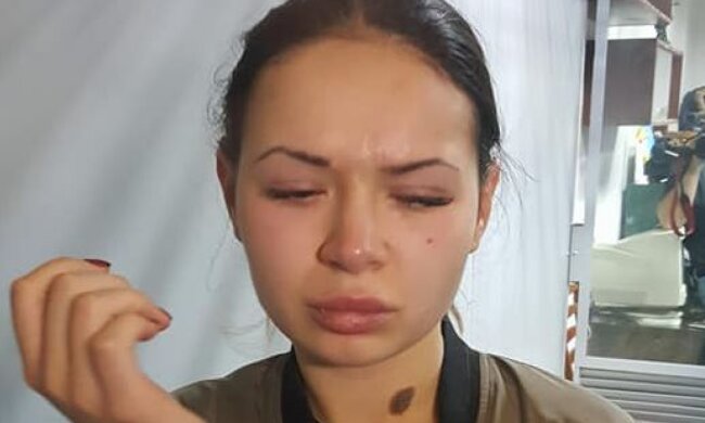 алена зайцева