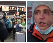 "Завели в приміщення і побили": в Одесі охорона супермаркету напала на покупця, фото