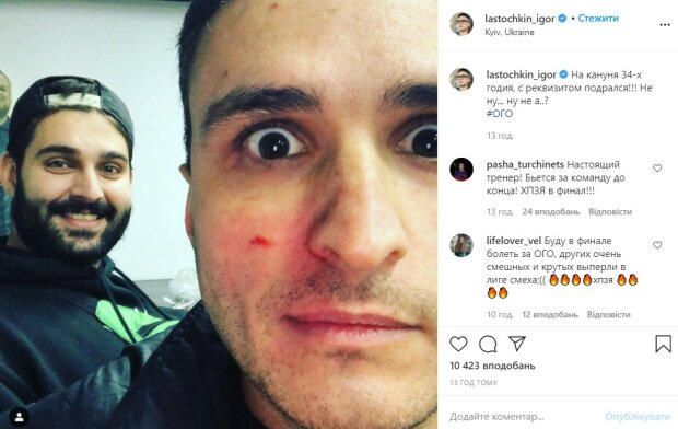Беда настигла звезду "Квартал 95" накануне дня рождения: фото "увечий"