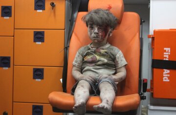 Image result for omran daqneesh
