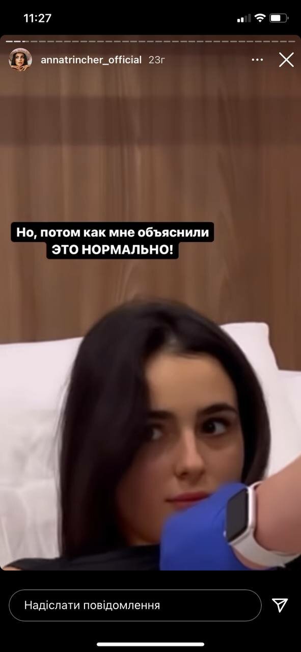 Анна Тринчер, которая перенесла тяжелую пластическую