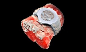 Снимок 3D-рентгена