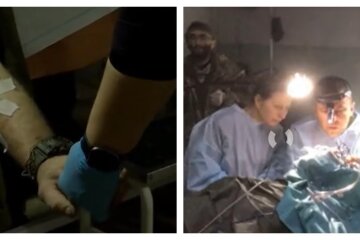 Под звуки взрывов и обстрелов: врач-добровольец провел операцию на открытом мозге защитнику Мариуполя, детали