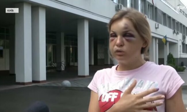 Чоловік журналістки, яку побили в поїзді, розповів про самопочуття сина: "Прости, що я ..."