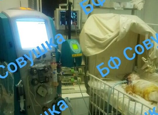 Реанимация и тяжелые ожоги: в Днепре борются за жизнь 4-летней девочки, людей просят о помощи