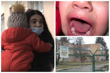 Дворічний малюк прийшов з дитсадка з розрізаним язиком, відео: вихователі звинуватили маму