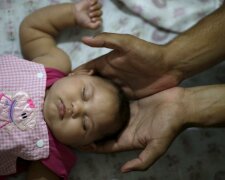 В Мексике растет число зараженных вирусов Зика беременных женщин
