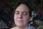 В Днепре просят помочь матери-одиночке с опухолью мозга: "почти не видит и не двигается"