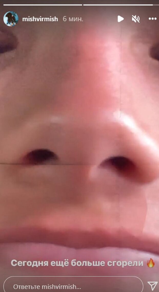 Новая беда настигла звезду Орел и Решка Андраде во время