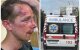 На ветерана ЗСУ напали через зачіску, фото: "Не міг навіть чинити опір"
