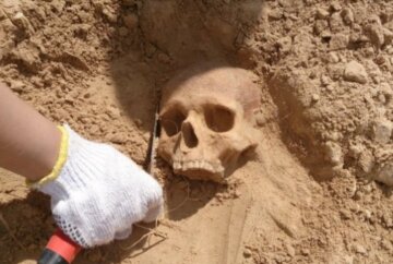 Археологи знайшли сліди найпершої операції в світі: черепу з пластиною 2 тисячі років, фото знахідки