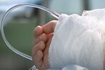 "Необходимо спасать руки": маленькая украинка прыгнула в кипяток, за жизнь малышки борются врачи