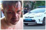 В Одесі розбірки завершилися стріляниною, серед поранених дитина: кадри з місця
