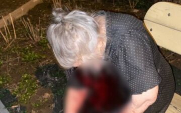 Украинец зверски избил пожилую мать, женщину нашли под подъездом: "Переломы носа и..."