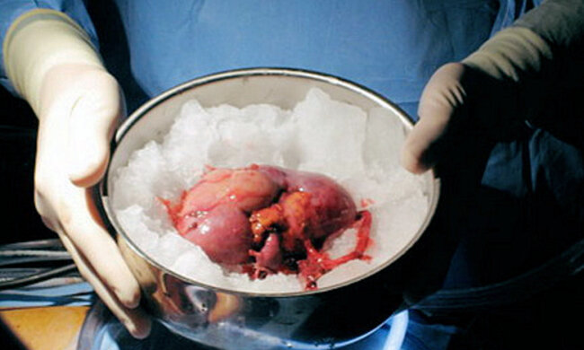 skolko-stoit-pochka3