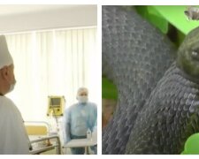 Лікарі не встигли допомогти: у маленької українки розвинулася гангрена через укус змії