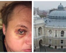 Скандал з нападом на режисера в Одесі набирає обертів: "вже били влітку і він хотів двічі..."
