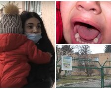 Двухлетний малыш пришел из детсада с разрезанным языком, видео: воспитатели обвинили маму