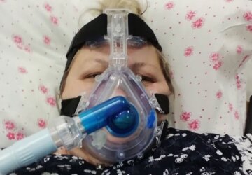 "23 днів коми і мінус 30 кілограм": Українка повернулася з того світу після боротьби з вірусом, розповівши про пережите