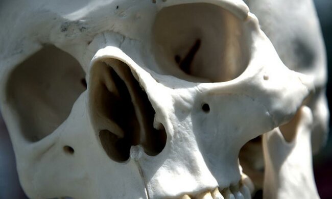 скелет, череп