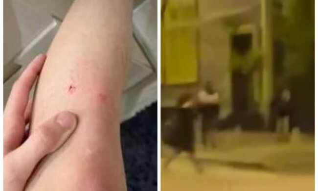 Известный украинец стал жертвой нападения в центре столицы: "Полиция так и не приехала"