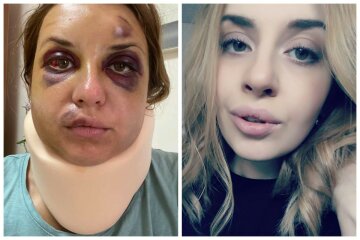 "Боїться залишатися один": журналістка, яку побили в потязі, розповіла про психічний стан сина
