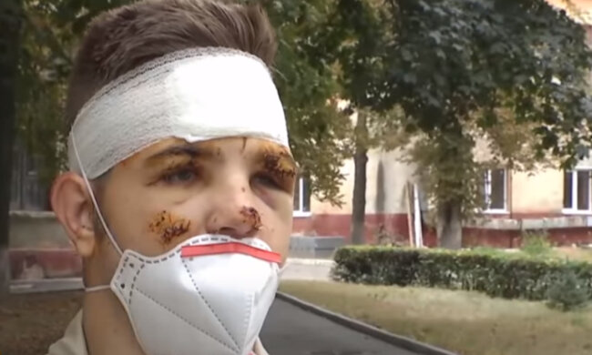 Курсант, що вижив у катастрофі "АН-26", розповів про порятунок друга: "намагався гасити, потім підбігли інші і..."