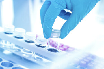 Вчені виявили бактерію, яка виробляє електрику: де живе і на що здатна