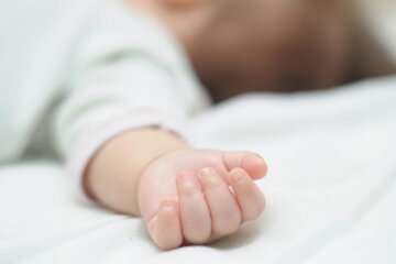 Немовля з обличчям вампіра налякав увесь світ: фото новонародженого
