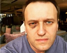 навальный глаз