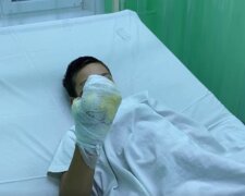 Однолітки підпалили дитину і зняли на камеру, хлопчик дивом залишився живий: "Я не хотів цього, але..."