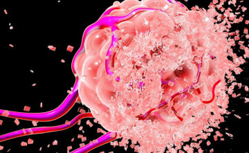 Tumour cell dissolving, artwork