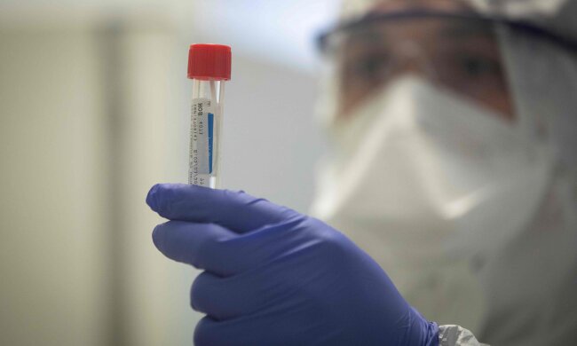 коронавірус, аналізи