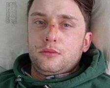 У Києві розшукують родичів молодого хлопця: "збила машина, і нічого не пам'ятає"